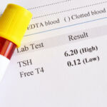 Thyroid Disease